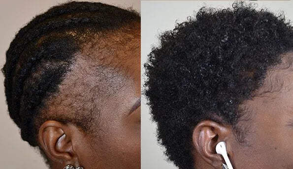 MEGA GROWTH (Potent Hair Oil - 3 Month Supply)